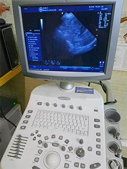 ultrasound imaging